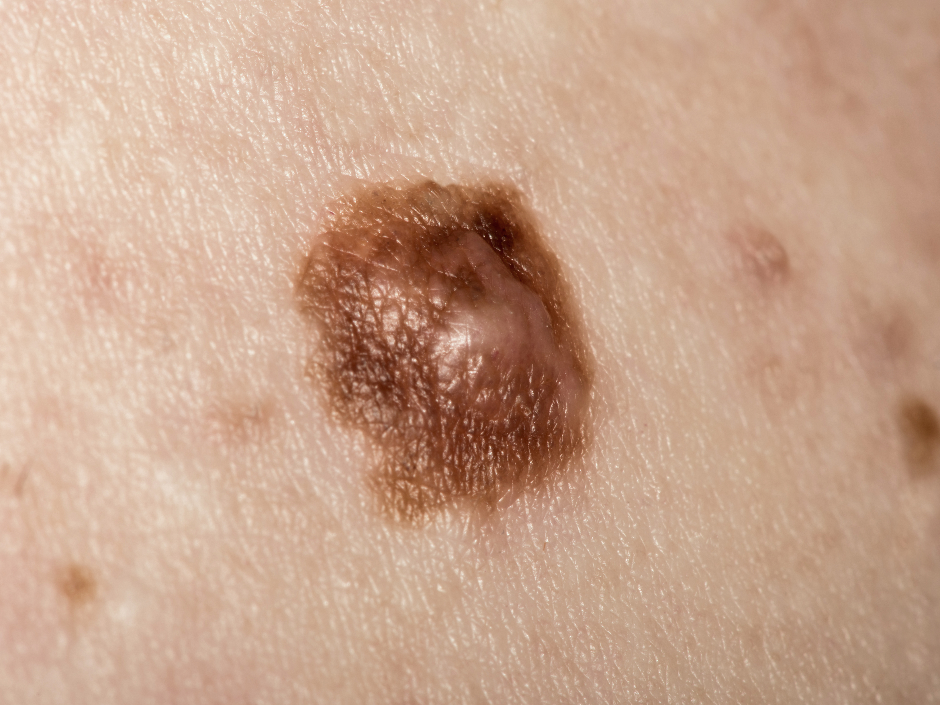 Mole
